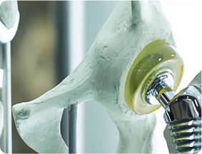 hip-joint-art