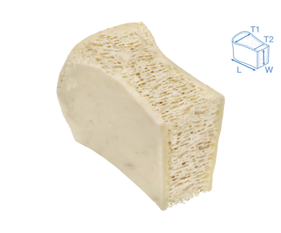 cancellous-bone
