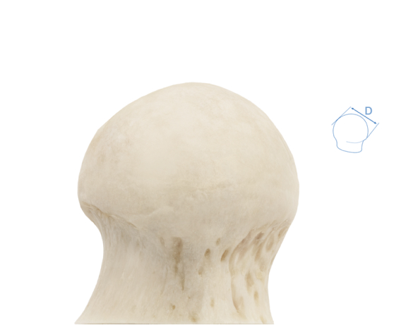 femoral-head