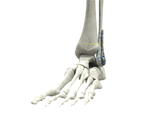 footandankle
