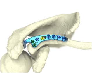 pelvis