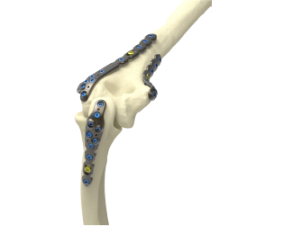 upper extremities bone images